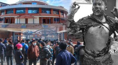 नगर प्रहरीको ‘ह्वील लक’पछि पठाओ चालकले राहदानी विभागअघि लगाए आगो, अवस्था गम्भीर